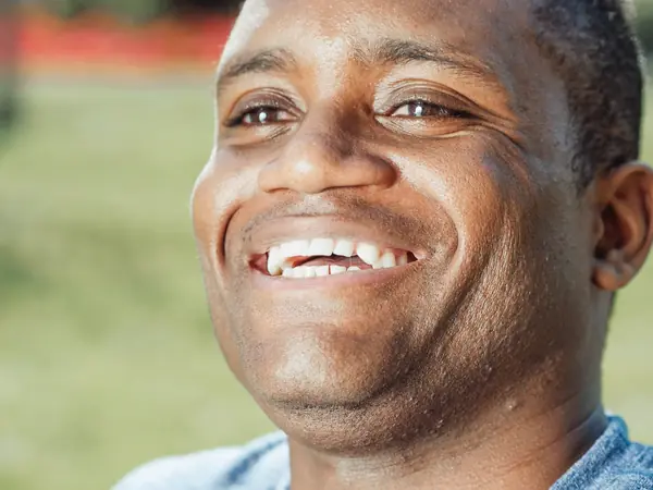 A man laughing outdoors with a full, natural smile